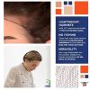 Disposable Hair Net 22 Inch. 1440 Pack Dark Brown Nylon Kitchen Hair Nets Food Service Disposable. 0.25 Inch Aperture Breathable Disposable Hair Cap.